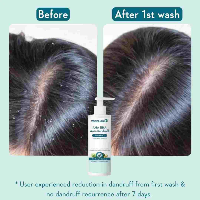 Wishcare AHA BHA Anti-Dandruff Shampoo (250ml)