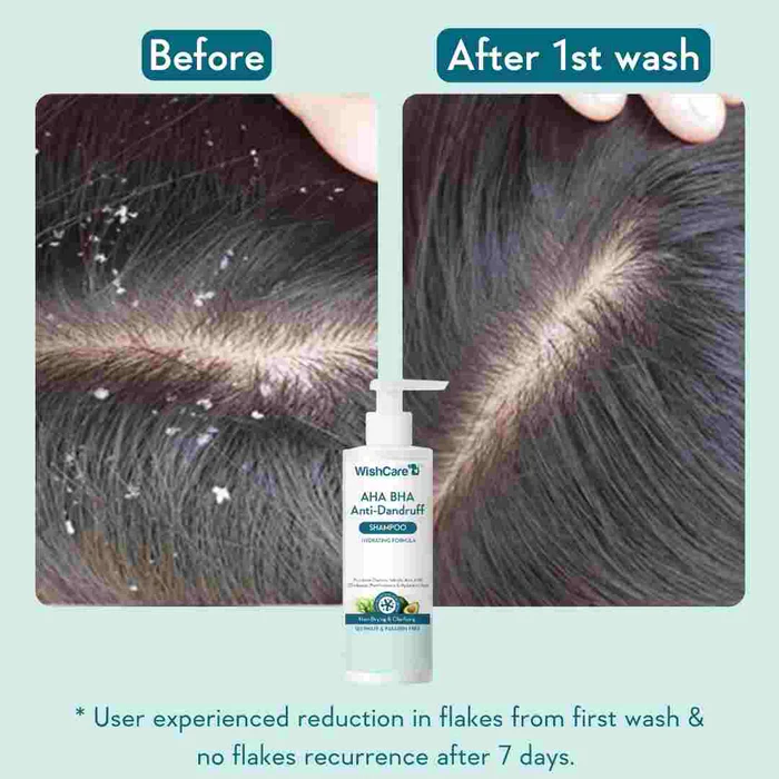 Wishcare AHA BHA Anti-Dandruff Shampoo (250ml)