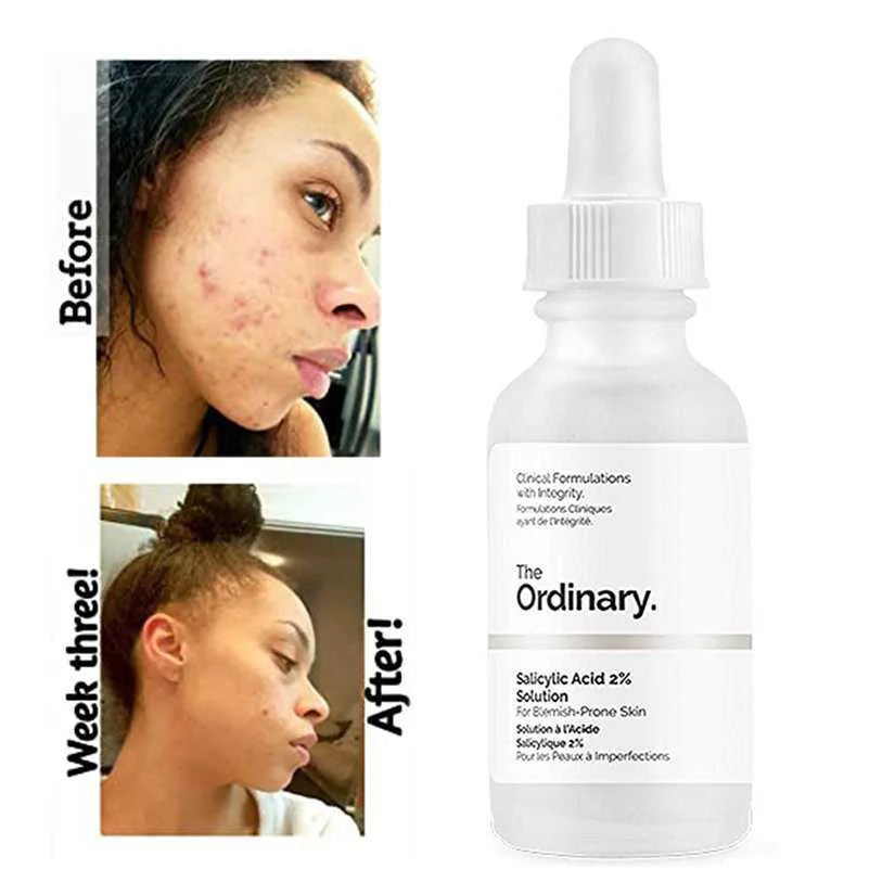 The Ordinary Salicylic Acid 2% Solution (30ml)