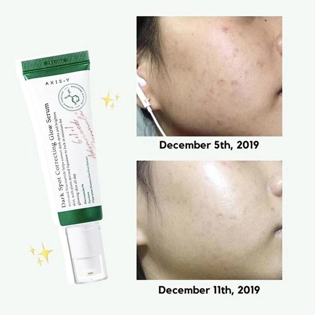 Axis_Y Dark Spot Correcting Glow Serum Corrects & Brightens (50ml)