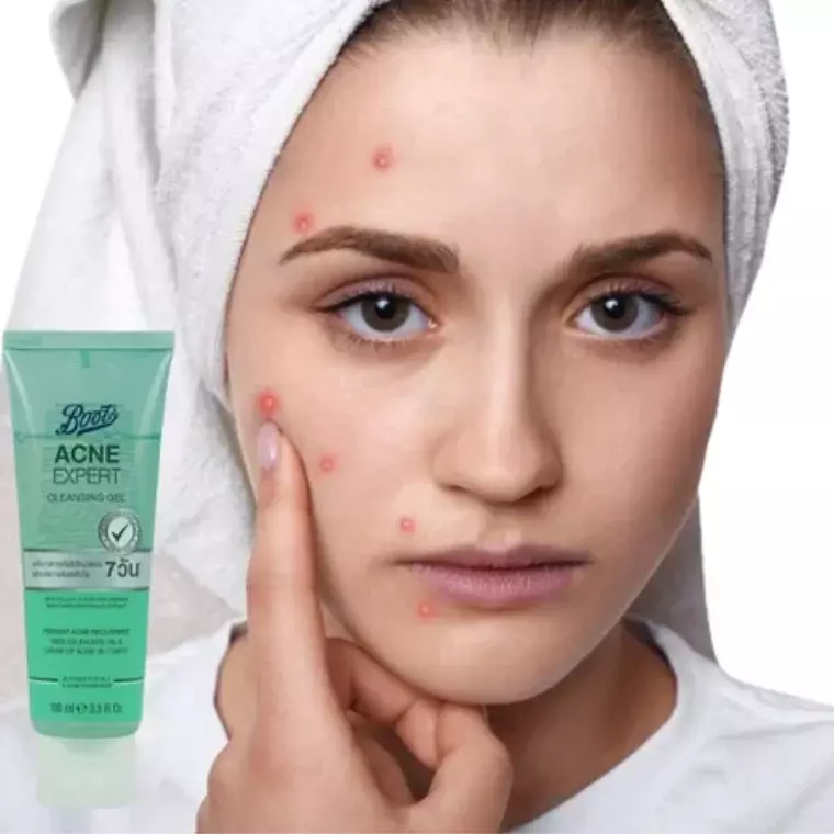Boots Acne Expert Cleansing Gel for Oily & Acne Skin (100ml)