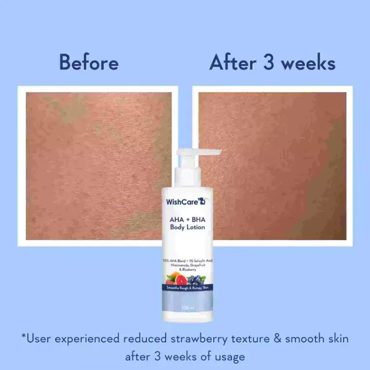 WishCare AHA + BHA Body Lotion (200ml)