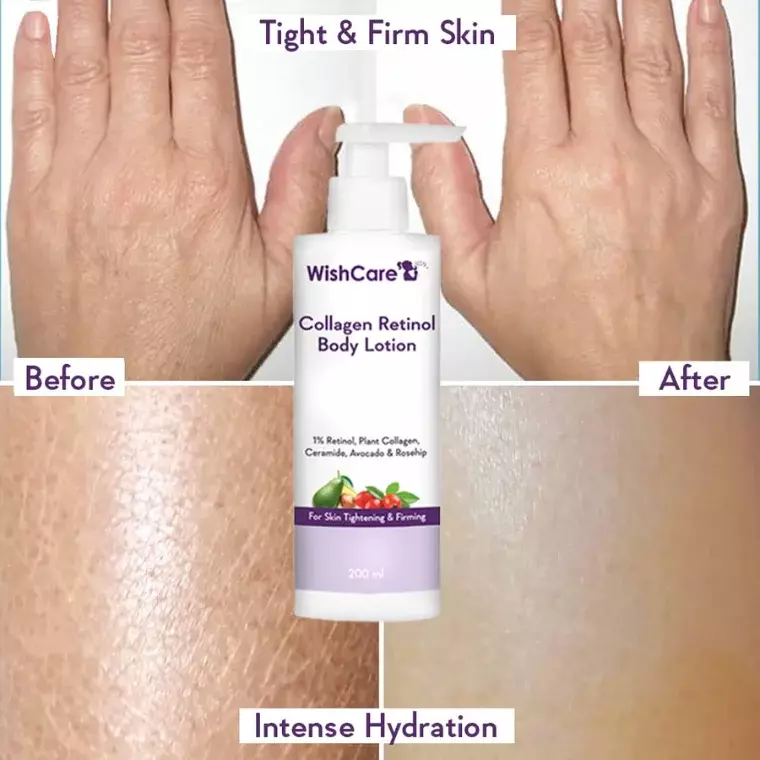 Wishcare Collagen 1% Retinol Body Lotion (200ml)